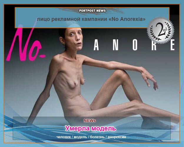 Умерла модель – лицо рекламной кампании «No Anоrexia»