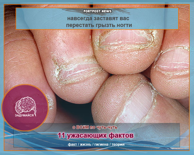 11 ужасающих фактов, которые навсегда заставят вас перестать грызть ногти (12 фото)