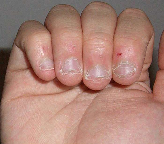 11 ужасающих фактов, которые навсегда заставят вас перестать грызть ногти