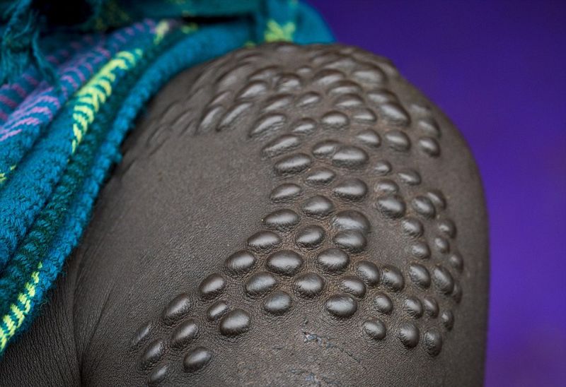 Шрамирование по-африкански с помощью колючек и лезвия