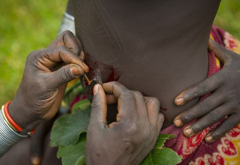Шрамирование по-африкански с помощью колючек и лезвия